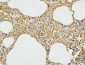 MMP-2 Polyclonal Antibody